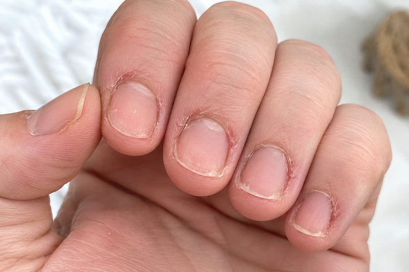 Pourquoi vos cuticules méritent toute votre attention