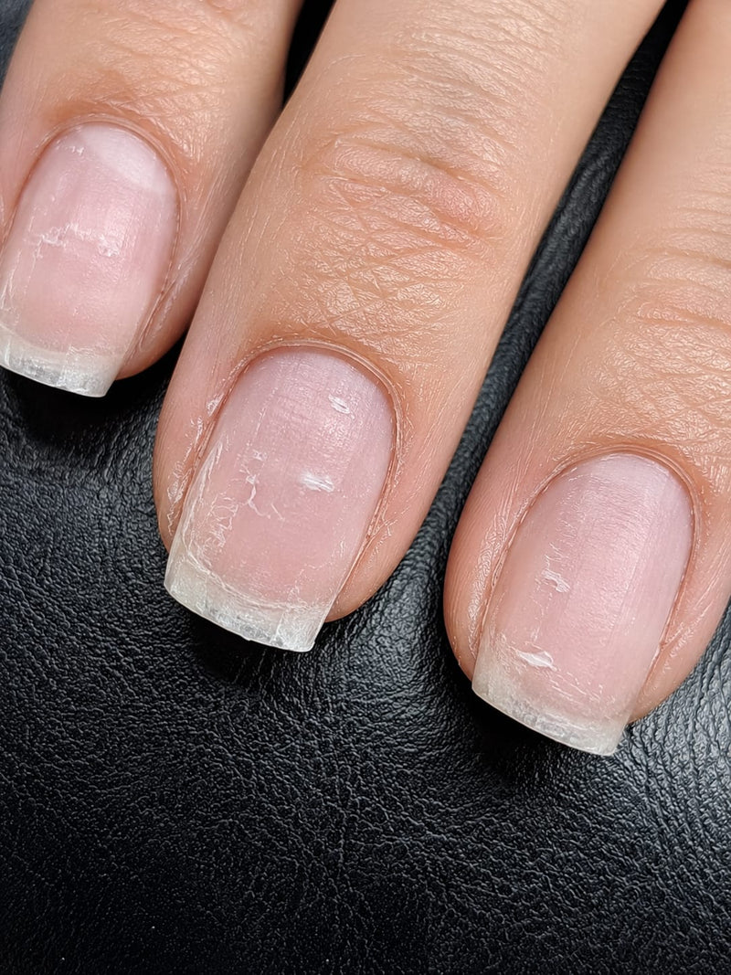 Ongles Secs : Causes et Routine Réparatrice | Huile Sakura